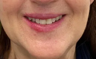 After - Westwood Dental Practice