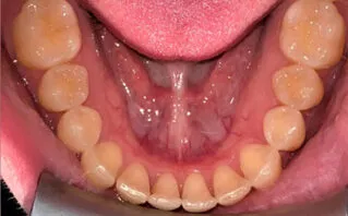 After - Westwood Dental Practice